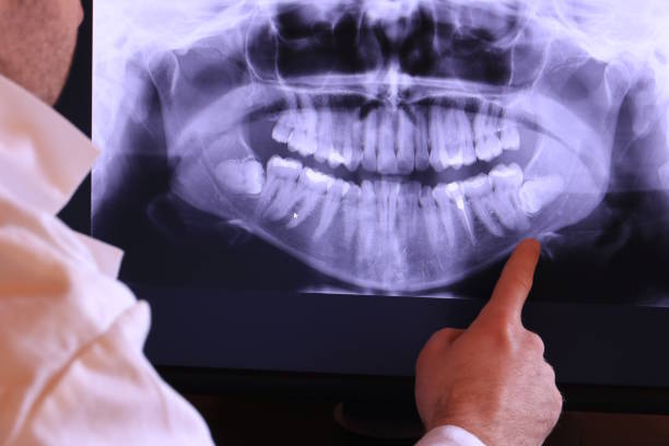 Best Broken or Cracked Tooth Emergency Dentist in Altamont, IL